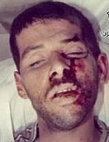 آلبوم اختصاصی تصاویر شهید مرتضی حسن دوست . کد 1403256320 آ